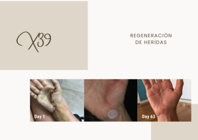 Antes y Después X39 | Regeneración de Heridads y Cicatrices